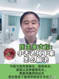 揭秘咽喉炎_劳累背后的健康危机及防护策略