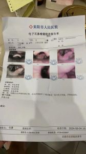 嗓子哑半月未愈？探秘病因及防治方法