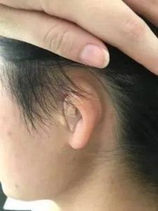 耳朵变小声七大原因及应对措施