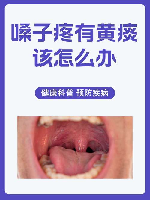 嗓子粗是怎么回事_嗓子粗？遗传？烟酒喊叫惹的祸！