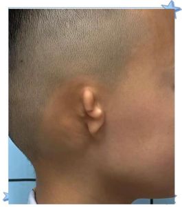 单侧耳朵像打鼓一样_耳朵咚咚响？别大意，可能是身体在报警！