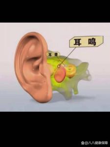 右耳朵里面轰隆轰隆响是怎么回事_耳朵轰隆响？别怕，可能是压力或噪音，调整生活或需看医生